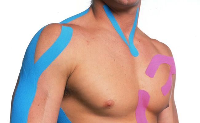 Kinesiotaping Beneficios Del Vendaje Neuromuscular